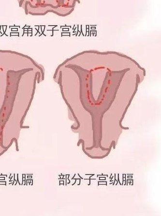 第三代试管婴儿微刺激方案促排卵需要几天？微刺激通常需要多少天才能促进排卵？