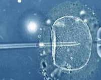 试管婴儿胆大（试管婴儿移植后腹水对胎儿有影响吗）