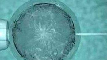 2月泰国玛祖医生介绍！玛祖医生为什么好？玛祖在哪个医院